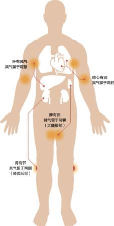 全身刮痧部位图解_图解大全 早晨在公园里常常可以见到这样的场景:中老年人在锻炼之余,还会拍拍双手双脚、拍拍背部。据说,这种拍打经络可以起到一定的防病、治病功效,特别对脏腑有一定的保健作用。但要提醒的是,经络拍打有秘诀,不是随便拍拍全身就可以,更不能随便到不正规的医馆拍打经络,手法不当或太重均有可能导致内伤。 新快报记者 林恒华 通讯员 张秋霞 乱拍乱打, 手法太重或致内伤 拍打经络曾经流行过一段时间,例如著名的敲胆经就是一种经典的拍打疗法。广州中医药大学第一附属医院推拿科主治医师林敏在接受新快报记